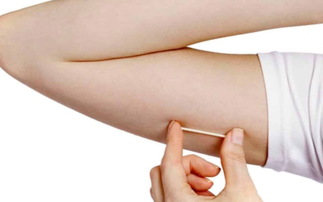 Implanon já beneficia mais de 500 mulheres